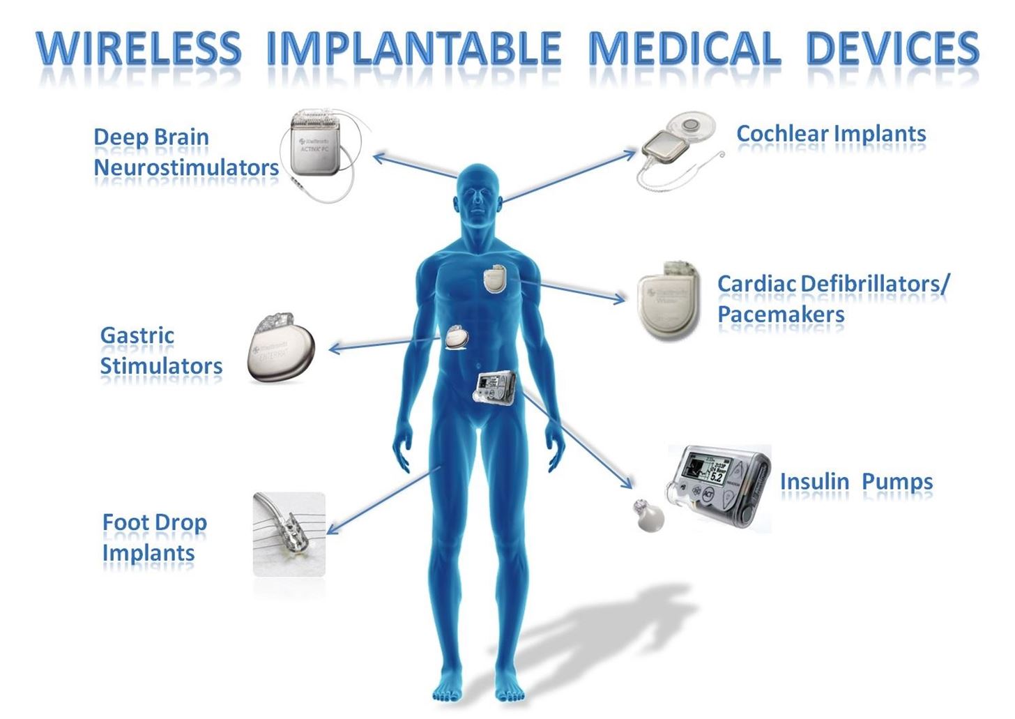 wireless implantable medical devices